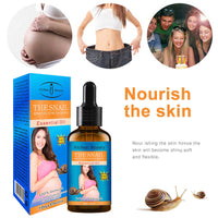 Aichun Beauty Stretch Mark Oil