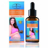 Aichun Beauty Stretch Mark Oil