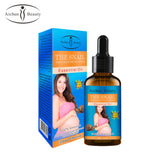 Aichun Beauty Stretch Mark Oil